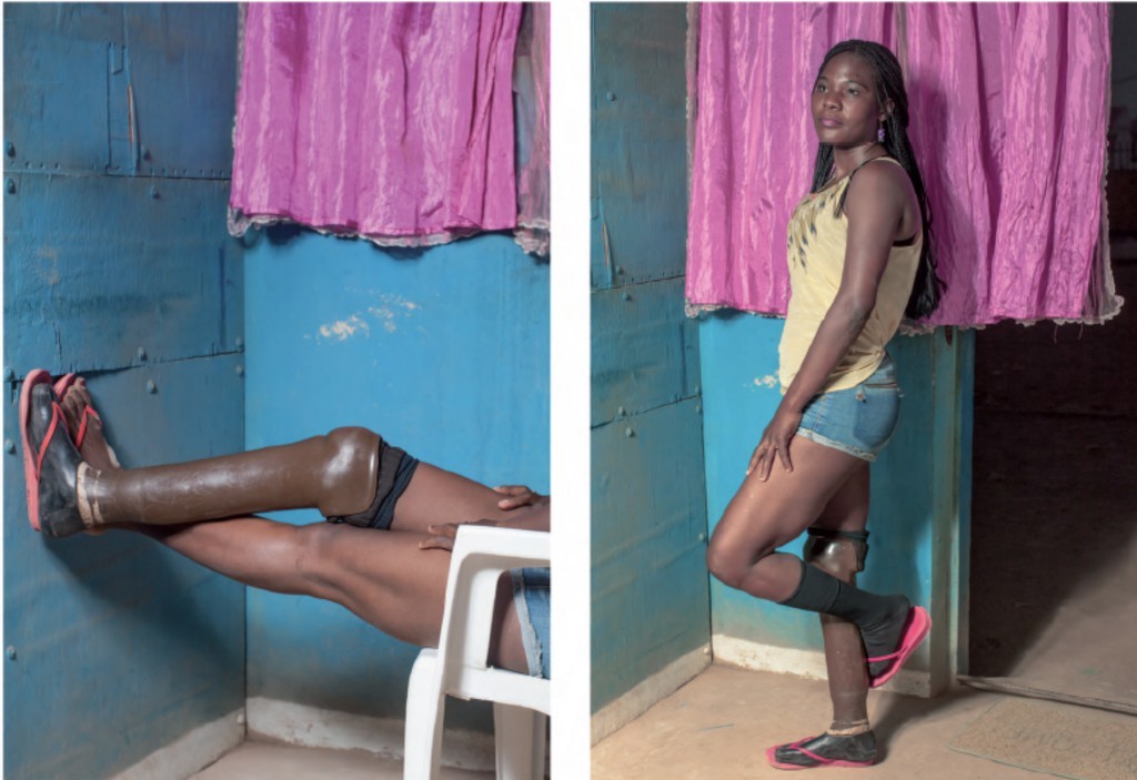 Behinderung in Angola. Kulturelle Techniken im Umgang mit beschädigter Identität