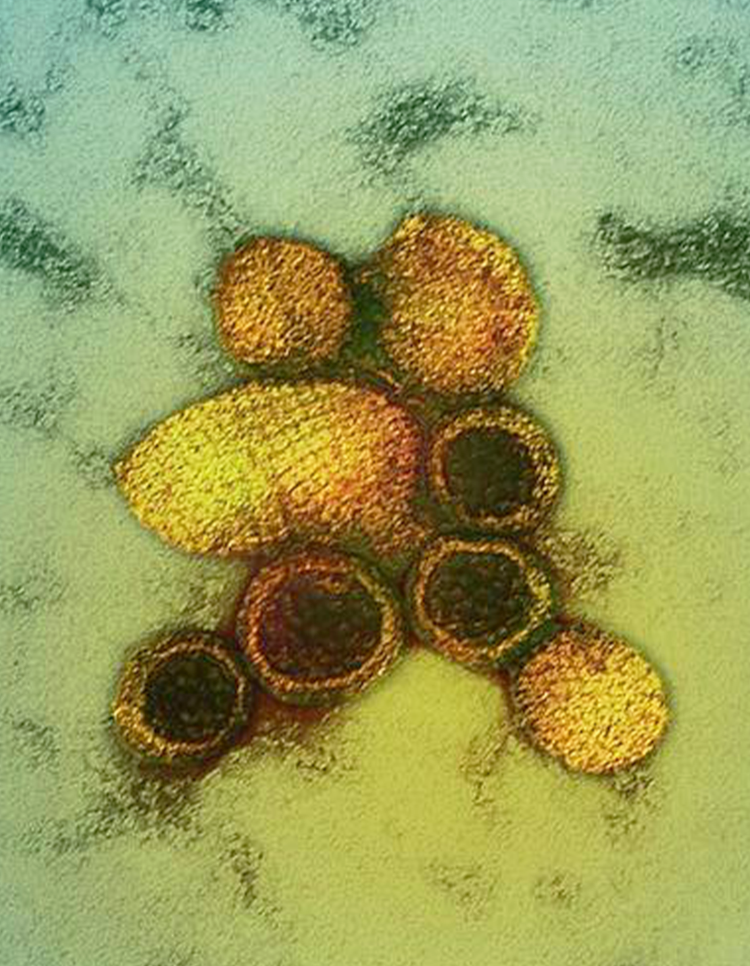 Virus Hanta